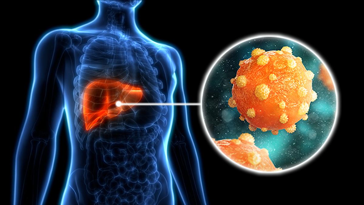 Gene therapy offers to beat hepatitis B virus by muting its DNA